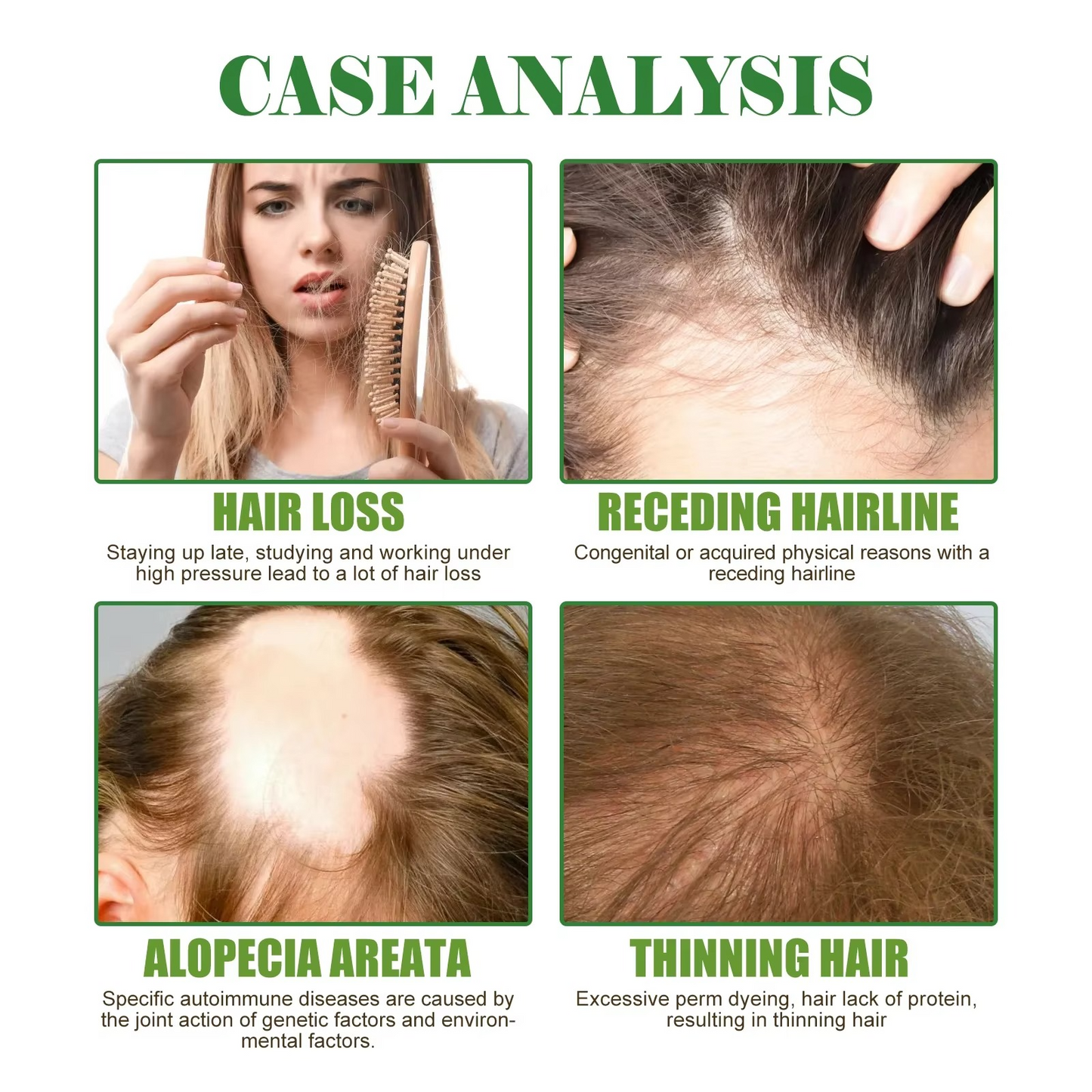 EELHOE Rosemary Mint Hair Growth Oil