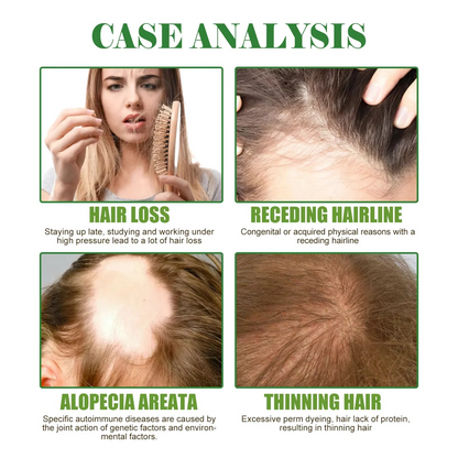 EELHOE Rosemary Mint Hair Growth Oil